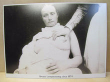 Load image into Gallery viewer, Old Medical Science Photo &quot;Breast Lumpectomy circa 1874&quot; Burns Archive NY Print
