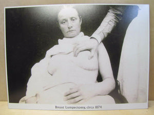 Old Medical Science Photo "Breast Lumpectomy circa 1874" Burns Archive NY Print